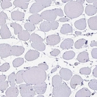 Immunohistochemical staining of human skeletal muscle shows no positivity in myocytes as expected.