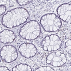 Immunohistochemical staining of human rectum shows no positivity in glandular cells as expected.