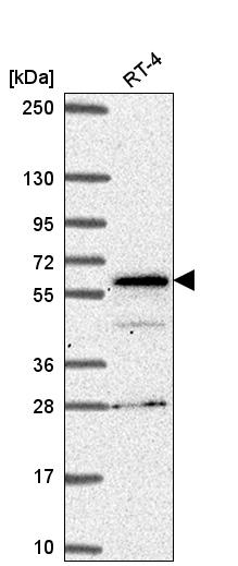 Anti-SP110 Antibody