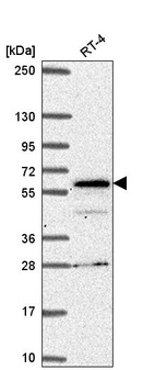 Anti-SP110 Antibody