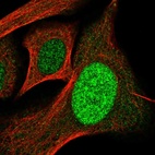 Anti-SP110 Antibody