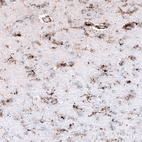 Immunohistochemical staining of human cerebral cortex shows moderate granular positivity in glial cells.