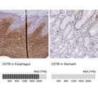 Anti-CSTB Antibody