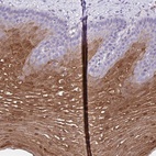 Anti-CSTB Antibody