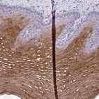 Immunohistochemical staining of human esophagus shows high expression.