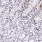Immunohistochemical staining of human stomach shows low expression as expected.