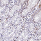 Anti-CSTB Antibody