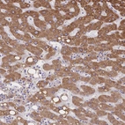 Immunohistochemical staining of human Liver shows strong cytoplasmic positivity in hepatocytes.