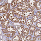 Immunohistochemical staining of human Kidney shows strong cytoplasmic positivity in cells in tubules.