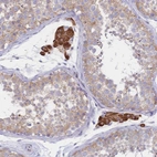 Immunohistochemical staining of human Testis shows strong cytoplasmic positivity in Leydig cells.