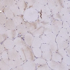 Immunohistochemical staining of human Skeletal muscle shows very weak cytoplasmic positivity in myocytes.