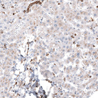 Immunohistochemical staining of human liver shows weak cytoplasmic positivity in hepatocytes.