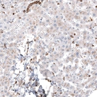 Immunohistochemical staining of human liver shows weak cytoplasmic positivity in hepatocytes.