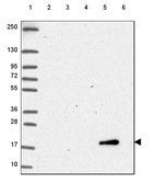 Lane 1: Marker [kDa] 250, 130, 95, 72, 55, 36, 28, 17, 10_br/_Lane 2: Human cell line RT-4_br/_Lane 3: Human cell line U-251 MG_br/_Lane 4: Human plasma_br/_Lane 5: Human Liver tissue_br/_Lane 6: Human Tonsil tissue