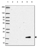 Lane 1: Marker [kDa] 250, 130, 95, 72, 55, 36, 28, 17, 10_br/_Lane 2: Human cell line RT-4_br/_Lane 3: Human cell line U-251 MG_br/_Lane 4: Human plasma_br/_Lane 5: Human Liver tissue_br/_Lane 6: Human Tonsil tissue