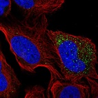 Immunofluorescent staining of human cell line U-2 OS shows localization to cytosol & vesicles.