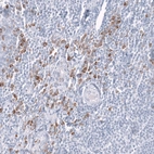 Immunohistochemical staining of human tonsil tissues shows strong membranous positivity in squamous epithelial cells.