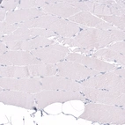 Immunohistochemical staining of human skeletal muscle shows no positivity in myocytes as expected.