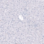 Immunohistochemical staining of human liver shows no positivity in hepatocytes as expected.