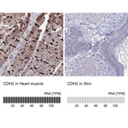 Anti-CDH2 Antibody