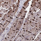 Immunohistochemical staining of human heart muscle shows strong membranous positivity in cardiomyocytes.