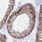 Immunohistochemical staining of human testis shows strong membranous positivity in cells in seminiferous ducts.