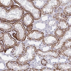 Immunohistochemical staining of human kidney shows strong membranous positivity in cells in tubules.
