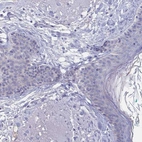Immunohistochemical staining of human skin shows no positivity in squamous epithelial cells as expected.
