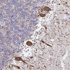 Anti-HMBOX1 Antibody