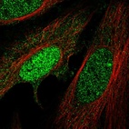 Immunofluorescent staining of human cell line HeLa shows localization to nucleoplasm & cytosol.