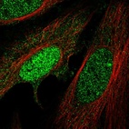 Anti-HMBOX1 Antibody