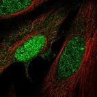 Immunofluorescent staining of human cell line HeLa shows localization to nucleoplasm & cytosol.