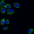 Immunofluorescence staining of A-431 cells using the Anti-TSPO monoclonal antibody, showing specific staining in mitochondria and vesicles in green. Nuclear probes are is visualized in blue (where available).