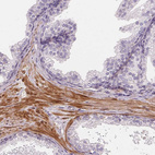 Immunohistochemical staining of human prostate shows moderate to strong cytoplasmic positivity in smooth muscle cells.
