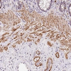 Immunohistochemical staining of human rectum shows moderate to strong cytoplasmic positivity in smooth muscle cells.