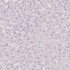 Immunohistochemical staining of human liver shows no positivity in hepatocytes as expected.