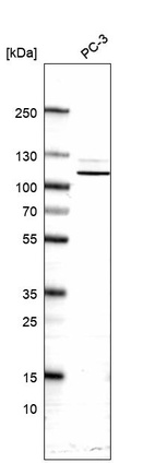 Western blot analysis in human cell line PC-3.