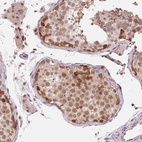 Anti-DNAJB6 Antibody