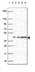 Lane 1: Marker [kDa] 250, 130, 95, 72, 55, 36, 28, 17, 10_br/_Lane 2: Human cell line RT-4_br/_Lane 3: Human cell line U-251 MG_br/_Lane 4: Human plasma_br/_Lane 5: Human Liver tissue_br/_Lane 6: Human Tonsil tissue