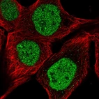 Immunofluorescent staining of human cell line A-431 shows localization to nucleoplasm.