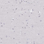 Immunohistochemical staining of human cerebral cortex shows low expression as expected.