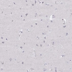Immunohistochemical staining of human cerebral cortex shows low expression as expected.