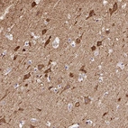 Immunohistochemical staining of human cerebral cortex shows strong cytoplasmic positivity in neurons.