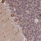 Immunohistochemical staining of human cerebellum shows strong cytoplasmic positivity in Purkinje cells.