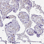 Immunohistochemical staining of human placenta shows negative cytoplasmic positivity in trophoblastic cells as expected.