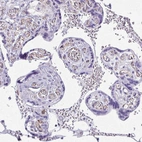 Immunohistochemical staining of human placenta shows negative cytoplasmic positivity in trophoblastic cells as expected.