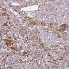 Immunohistochemical staining of human adrenal gland shows moderate cytoplasmic positivity in glandular cells.