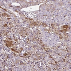 Immunohistochemical staining of human adrenal gland shows moderate cytoplasmic positivity in glandular cells.