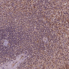 Anti-STAT3 Antibody