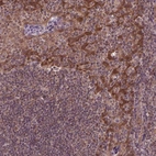 Immunohistochemical staining of human tonsil shows strong cytoplasmic positivity in squamous epithelial cells.